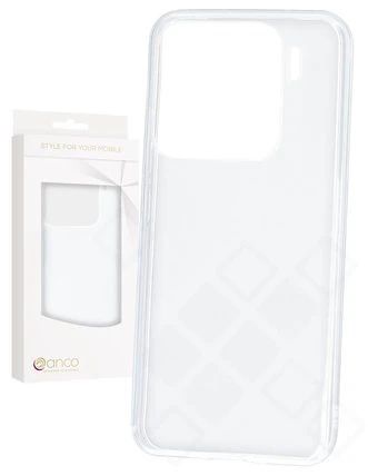 Silikon / TPU Hülle Xiaomi 15 in transparent - Schutzhülle